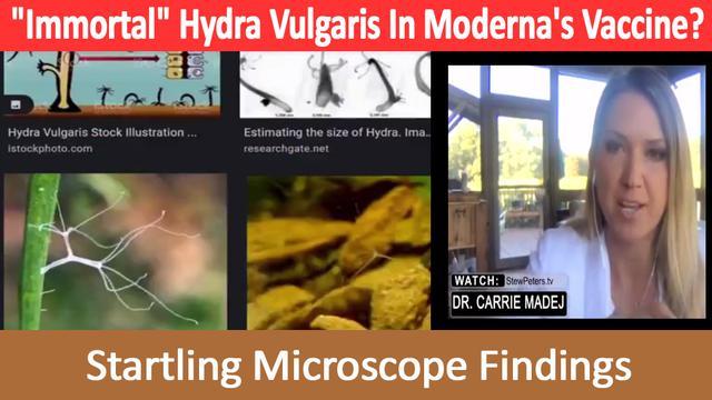 Dr Carrie Madej: Hydra Vulgaris in VAX!!!