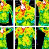 thermography