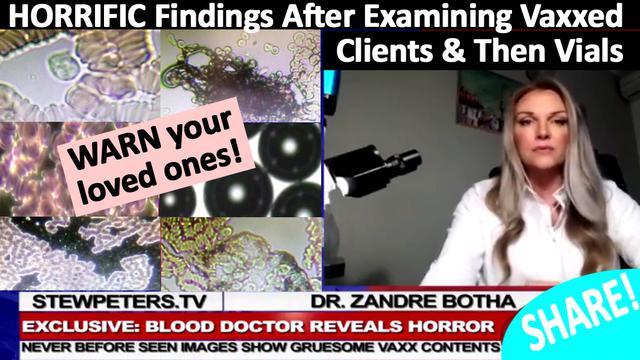 Dr. Zandre Botha Reveals Her HORRIFIC Findings After Examining Vaxxed Clients & Then Vials